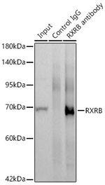 RXRB Antibody in Immunoprecipitation (IP)