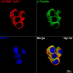 IGF2BP1 Recombinant Rabbit Monoclonal Antibody (1D7A0)