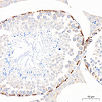 IGF2BP1 Antibody in Immunohistochemistry (Paraffin) (IHC (P))