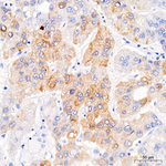 IGF2BP1 Antibody in Immunohistochemistry (Paraffin) (IHC (P))