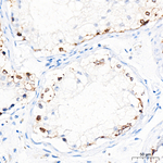IGF2BP1 Antibody in Immunohistochemistry (Paraffin) (IHC (P))