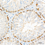 IGF2BP1 Antibody in Immunohistochemistry (Paraffin) (IHC (P))