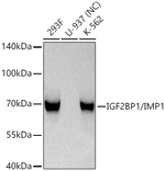 IGF2BP1 Antibody in Western Blot (WB)