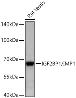 IGF2BP1 Antibody in Western Blot (WB)