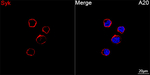 Syk Antibody in Immunocytochemistry (ICC/IF)