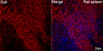 Syk Antibody in Immunohistochemistry (Paraffin) (IHC (P))