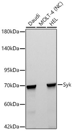 Syk Antibody in Western Blot (WB)