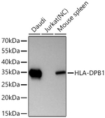 HLA-DPB1 Antibody in Western Blot (WB)