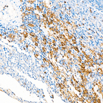 CD18 Antibody in Immunohistochemistry (Paraffin) (IHC (P))