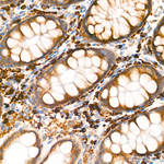SND1 Antibody in Immunohistochemistry (Paraffin) (IHC (P))