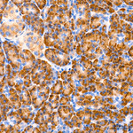 SND1 Antibody in Immunohistochemistry (Paraffin) (IHC (P))