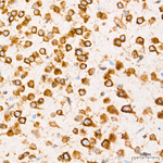 SND1 Antibody in Immunohistochemistry (Paraffin) (IHC (P))
