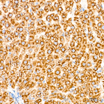SND1 Antibody in Immunohistochemistry (Paraffin) (IHC (P))
