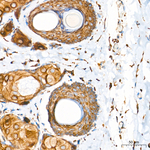 SND1 Antibody in Immunohistochemistry (Paraffin) (IHC (P))