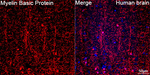 MBP Antibody in Immunohistochemistry (Paraffin) (IHC (P))
