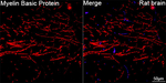 MBP Antibody in Immunohistochemistry (Paraffin) (IHC (P))