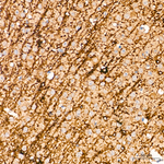 SIRT2 Antibody in Immunohistochemistry (Paraffin) (IHC (P))