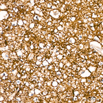 SIRT2 Recombinant Rabbit Monoclonal Antibody (1E3C6)