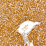 CYB5R3 Antibody in Immunohistochemistry (Paraffin) (IHC (P))