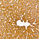 CYB5R3 Antibody in Immunohistochemistry (Paraffin) (IHC (P))