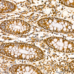 TRIM25 Antibody in Immunohistochemistry (Paraffin) (IHC (P))