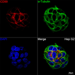 CD99 Recombinant Rabbit Monoclonal Antibody (2M1K9)