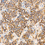 CD99 Antibody in Immunohistochemistry (Paraffin) (IHC (P))