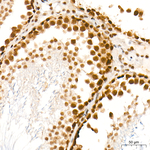 POLR2L Antibody in Immunohistochemistry (Paraffin) (IHC (P))
