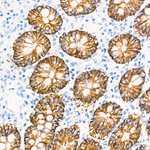 Claudin 1 Antibody in Immunohistochemistry (Paraffin) (IHC (P))