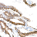 Claudin 1 Antibody in Immunohistochemistry (Paraffin) (IHC (P))