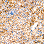 Claudin 1 Antibody in Immunohistochemistry (Paraffin) (IHC (P))