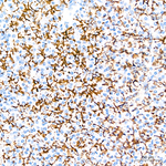 Claudin 1 Antibody in Immunohistochemistry (Paraffin) (IHC (P))