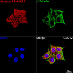 Annexin A1 Antibody in Immunocytochemistry (ICC/IF)