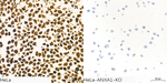 Annexin A1 Antibody in Immunocytochemistry (ICC/IF)