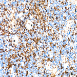Annexin A1 Antibody in Immunohistochemistry (Paraffin) (IHC (P))