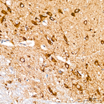 COX7A2L Antibody in Immunohistochemistry (Paraffin) (IHC (P))