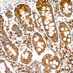 COX7A2L Antibody in Immunohistochemistry (Paraffin) (IHC (P))
