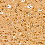 COX7A2L Antibody in Immunohistochemistry (Paraffin) (IHC (P))