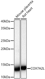 COX7A2L Antibody in Western Blot (WB)