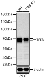 TFEB Antibody in Western Blot (WB)