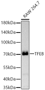 TFEB Antibody in Western Blot (WB)