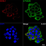 ACSL1 Antibody in Immunocytochemistry (ICC/IF)