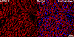 ACSL1 Antibody in Immunohistochemistry (Paraffin) (IHC (P))