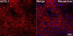 ACSL1 Antibody in Immunohistochemistry (Paraffin) (IHC (P))