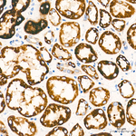 ACSL1 Antibody in Immunohistochemistry (Paraffin) (IHC (P))