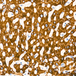 ACSL1 Antibody in Immunohistochemistry (Paraffin) (IHC (P))