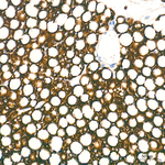 ACSL1 Antibody in Immunohistochemistry (Paraffin) (IHC (P))