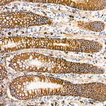 ITGA3 Antibody in Immunohistochemistry (Paraffin) (IHC (P))