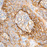 ITGA3 Antibody in Immunohistochemistry (Paraffin) (IHC (P))