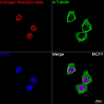 Estrogen Receptor beta Antibody in Immunocytochemistry (ICC/IF)